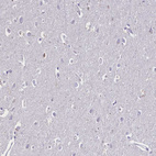 Immunohistochemical staining of human cerebral cortex shows no positivity in neuronal cells as expected.