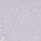 Anti-FAM209B Antibody