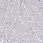 Immunohistochemical staining of human cerebral cortex shows no positivity in neuronal cells as expected.