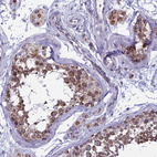 Immunohistochemical staining of human testis shows strong cytoplasmic-membranous positivity in cells in seminiferous ducts and leydig cells.