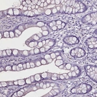 Immunohistochemical staining of human small intestine shows no positivity in glandular cells as expected.