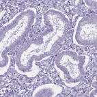 Immunohistochemical staining of human endometrium shows no positivity in glandular cells as expected.