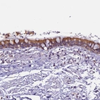 Anti-CEP170 Antibody