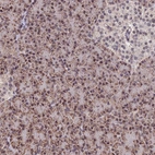 Anti-REXO1 Antibody