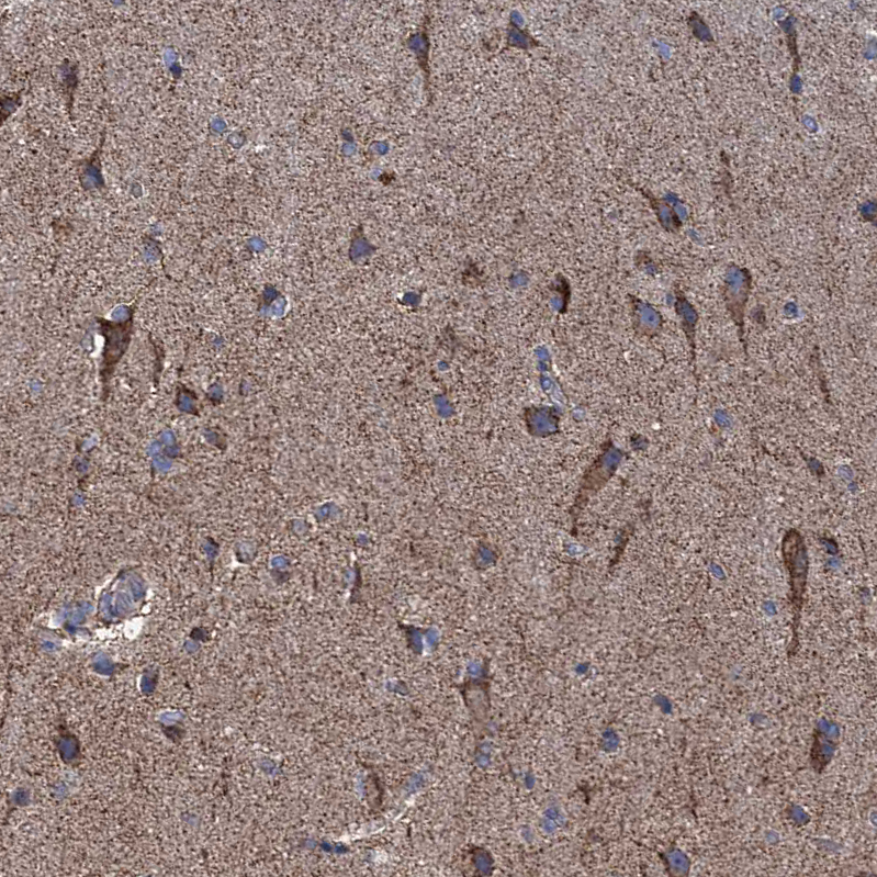 Anti-GTPBP3 Antibody