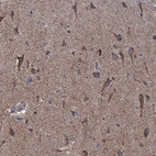 Anti-GTPBP3 Antibody