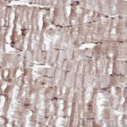 Immunohistochemical staining of human skeletal muscle shows moderate cytoplasmic positivity in myocytes.