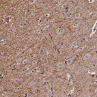 Immunohistochemical staining of human cerebral cortex shows strong cytoplasmic positivity in neuropil.