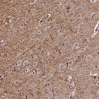 Immunohistochemical staining of human cerebral cortex shows strong cytoplasmic positivity in neuropil.