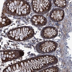 Immunohistochemical staining of human colon shows strong cytoplasmic granular positivity in glandular cells.