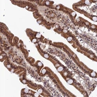 Immunohistochemical staining of human duodenum shows strong cytoplasmic positivity in glandular cells.
