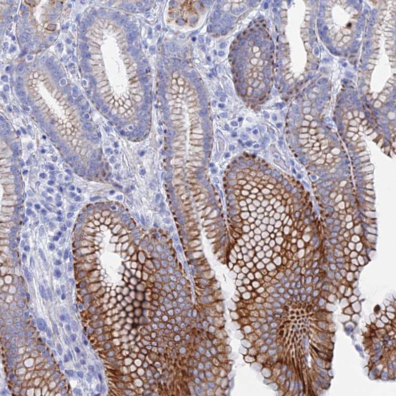 Anti-DHX34 Antibody