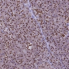 Anti-IRF2BP1 Antibody