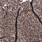 Anti-SNRK Antibody