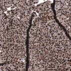 Anti-SNRK Antibody
