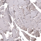 Immunohistochemical staining of human skeletal muscle shows strong nuclear positivity in myocytes.