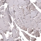 Immunohistochemical staining of human skeletal muscle shows strong nuclear positivity in myocytes.