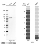 Western blot analysis in human cell lines PC-3 and MCF-7 using Anti-SNRK antibody. Corresponding SNRK RNA-seq data are presented for the same cell lines. Loading control: Anti-PPIB.