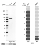 Western blot analysis in human cell lines PC-3 and MCF-7 using Anti-SNRK antibody. Corresponding SNRK RNA-seq data are presented for the same cell lines. Loading control: Anti-PPIB.