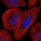 Immunofluorescent staining of human cell line U-2 OS shows localization to cell junctions & vesicles.
