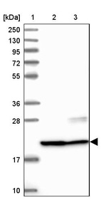 Lane 1: Marker [kDa] 250, 130, 95, 72, 55, 36, 28, 17, 10_br/_Lane 2: Human cell line RT-4_br/_Lane 3: Human cell line U-251MG sp