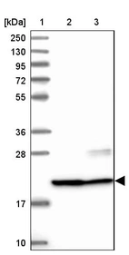 Lane 1: Marker [kDa] 250, 130, 95, 72, 55, 36, 28, 17, 10_br/_Lane 2: Human cell line RT-4_br/_Lane 3: Human cell line U-251MG sp