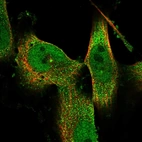Immunofluorescent staining of human cell line U-251 MG shows localization to nucleoplasm, cytosol & centrosome.