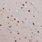 Anti-RBM4 Antibody