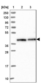 Lane 1: Marker [kDa] 250, 130, 95, 72, 55, 36, 28, 17, 10_br/_Lane 2: Human cell line RT-4_br/_Lane 3: Human cell line U-251 MG