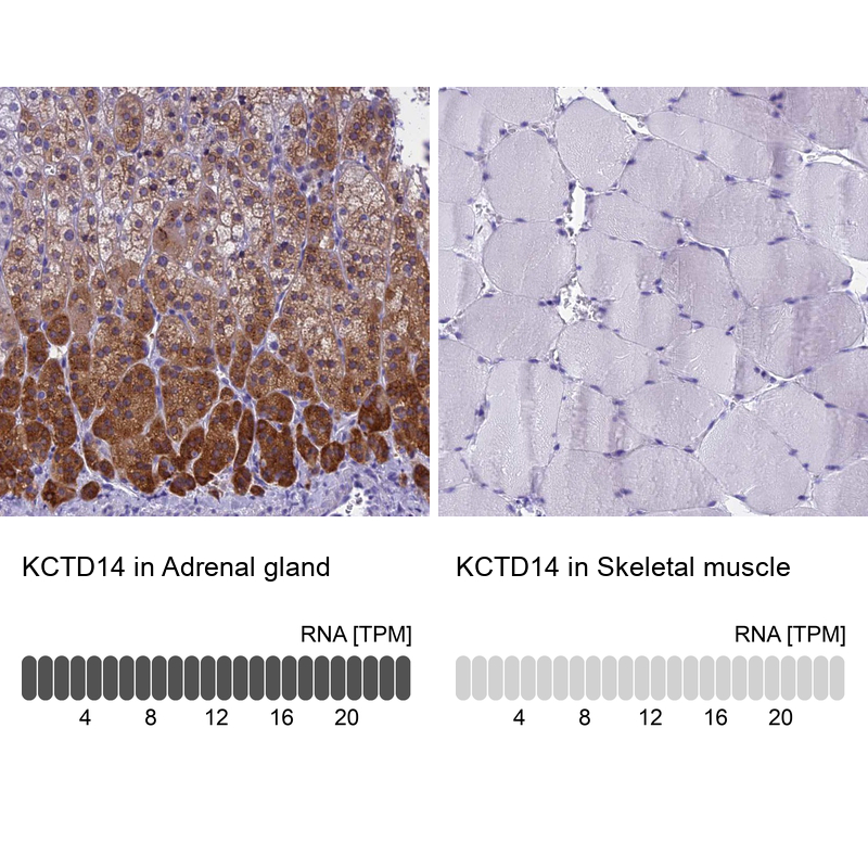 Anti-KCTD14 Antibody