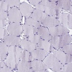Immunohistochemical staining of human skeletal muscle shows low expression as expected.