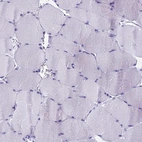 Immunohistochemical staining of human skeletal muscle shows low expression as expected.