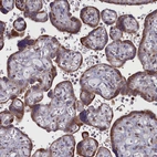 Immunohistochemical staining of human placenta shows moderate granular cytoplasmic positivity in trophoblastic cells.