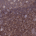 Anti-CIAPIN1 Antibody