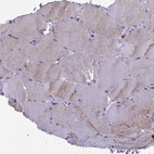 Immunohistochemical staining of human skeletal muscle shows very weak positivity in myocytes as expected.