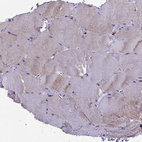 Anti-CIAPIN1 Antibody