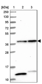 Lane 1: Marker [kDa] 250, 130, 95, 72, 55, 36, 28, 17, 10_br/_Lane 2: Human cell line RT-4_br/_Lane 3: Human cell line U-251MG sp