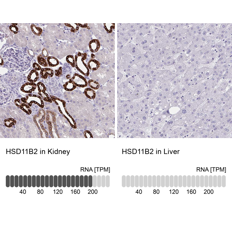 Anti-HSD11B2 Antibody