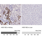 Anti-HSD11B2 Antibody