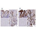 Anti-HSD11B2 Antibody