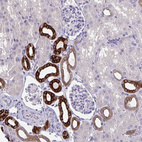 Anti-HSD11B2 Antibody