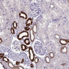 Immunohistochemical staining of human kidney shows strong cytoplasmic positivity in cells in tubules.