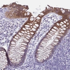 Immunohistochemical staining of human rectum shows strong cytoplasmic positivity in glandular cells.
