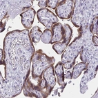 Immunohistochemical staining of human placenta shows strong cytoplasmic positivity in trophoblastic cells.