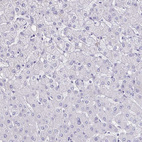 Immunohistochemical staining of human liver shows no positivity in hepatocytes as expected.