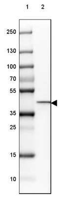Lane 1: Marker [kDa] 250, 130, 100, 70, 55, 35, 25, 15, 10_br/_Lane 2: Human Kidney tissue
