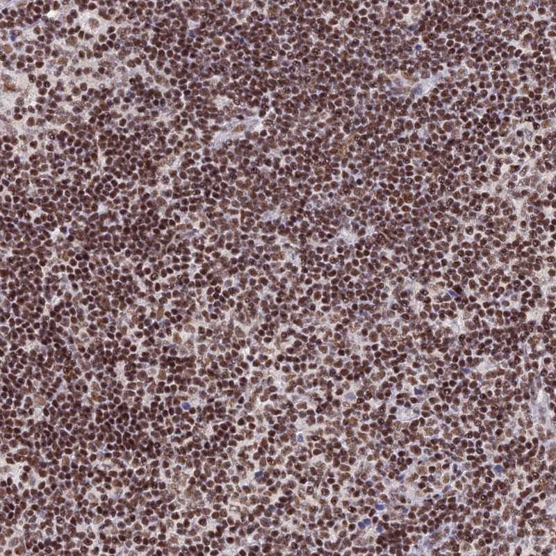 Anti-THAP11 Antibody