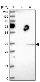 Lane 1: Marker [kDa] 250, 130, 95, 72, 55, 36, 28, 17, 10_br/_Lane 2: Human cell line RT-4_br/_Lane 3: Human cell line U-251MG sp