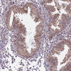 Immunohistochemical staining of human endometrium shows moderate cytoplasmic positivity in glandular cells.