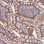 Immunohistochemical staining of human small intestine shows moderate cytoplasmic/membranous positivity in glandular cells.